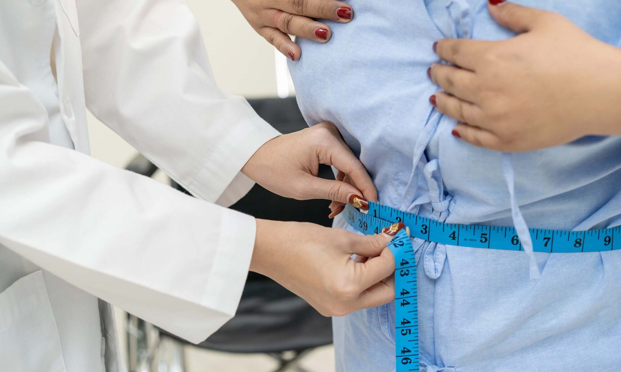 Obese woman: Causes, Health Risks, Statistics & New GLP-1 Treatments