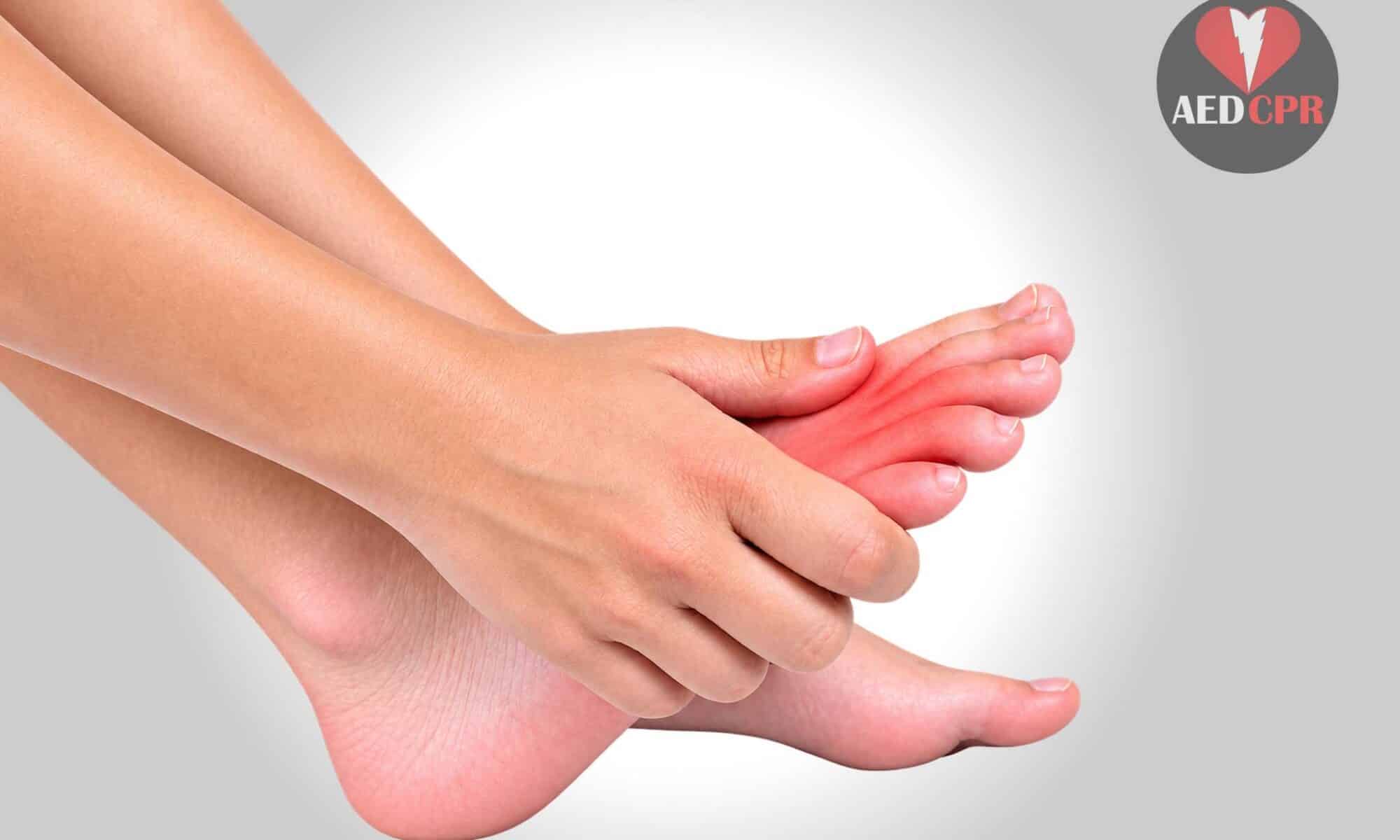 Broken toe vs sprained toe - What's the difference?