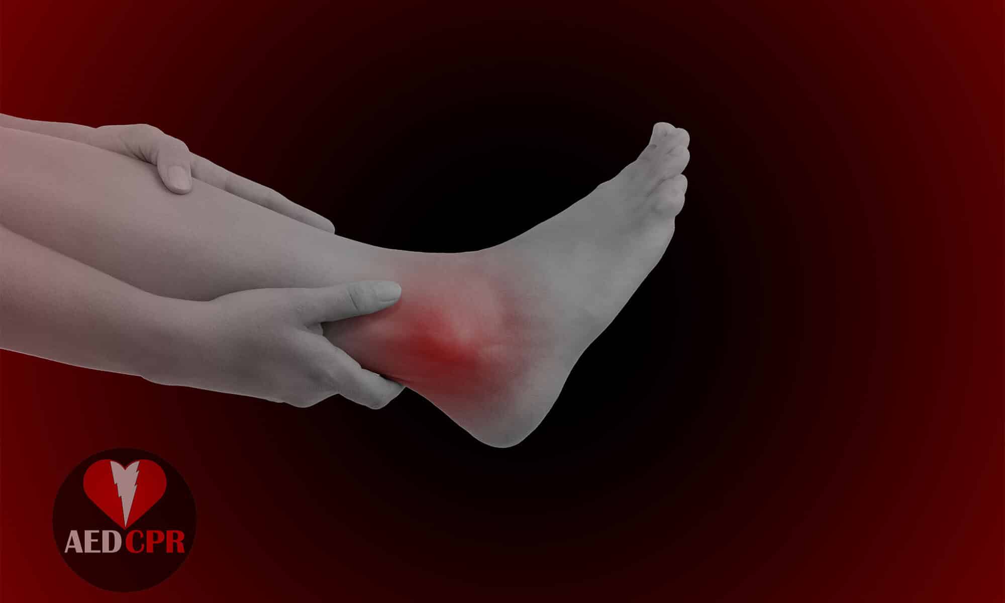 Sprained vs Broken Ankle