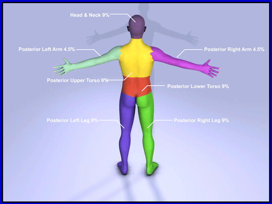 Posterior view of body to illustrate the Rule of 9's