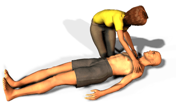  If you are faced with an emergency situation and do not have proper protective equipment then it is acceptable to do Compression Only CPR.